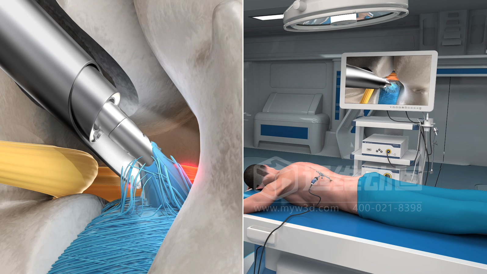 企業(yè)制作工程施工|自動化生產(chǎn)線|產(chǎn)品演示|醫(yī)學(xué)行業(yè)三維動畫要準(zhǔn)備哪些資料，以便有效地提供給三維動畫制作公司呢？(圖7)