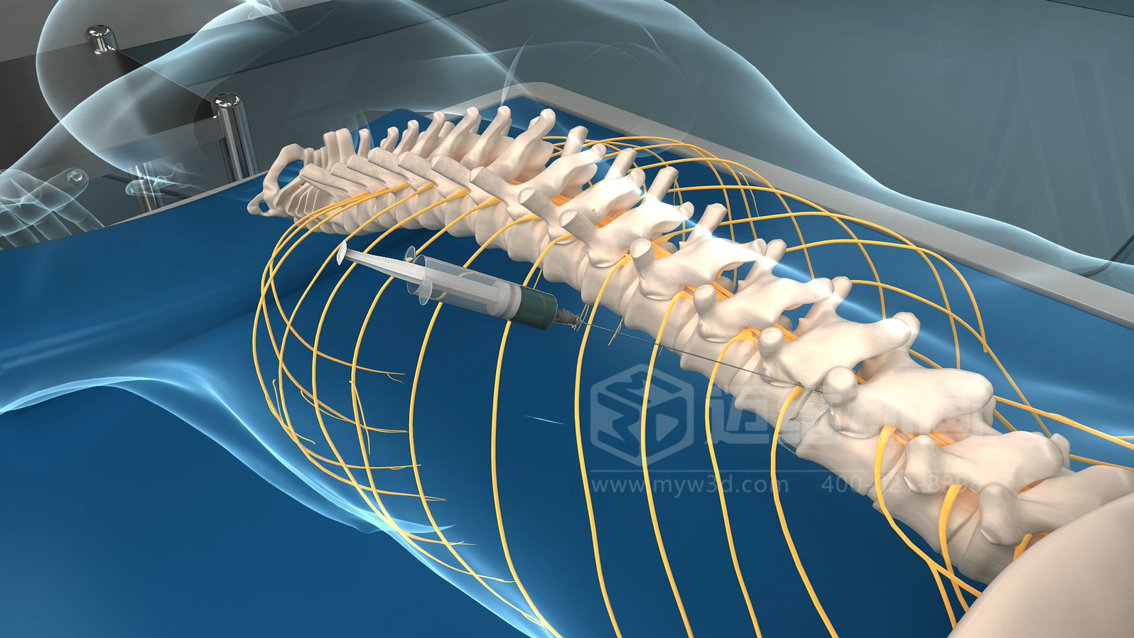 從實(shí)驗(yàn)室到手術(shù)室：邁維動(dòng)漫用三維動(dòng)畫，讓精密科技“看得見，懂得到”訂單轉(zhuǎn)化率提高 50%(圖6)