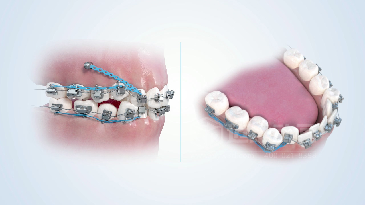 從實(shí)驗(yàn)室到手術(shù)室：邁維動(dòng)漫用三維動(dòng)畫，讓精密科技“看得見，懂得到”訂單轉(zhuǎn)化率提高 50%(圖10)