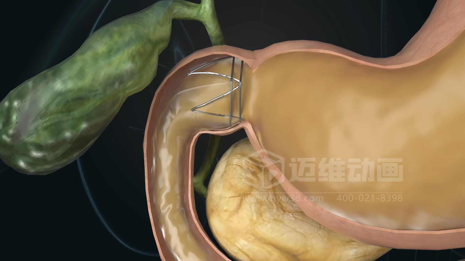 從實(shí)驗(yàn)室到手術(shù)室：邁維動(dòng)漫用三維動(dòng)畫，讓精密科技“看得見，懂得到”訂單轉(zhuǎn)化率提高 50%(圖11)