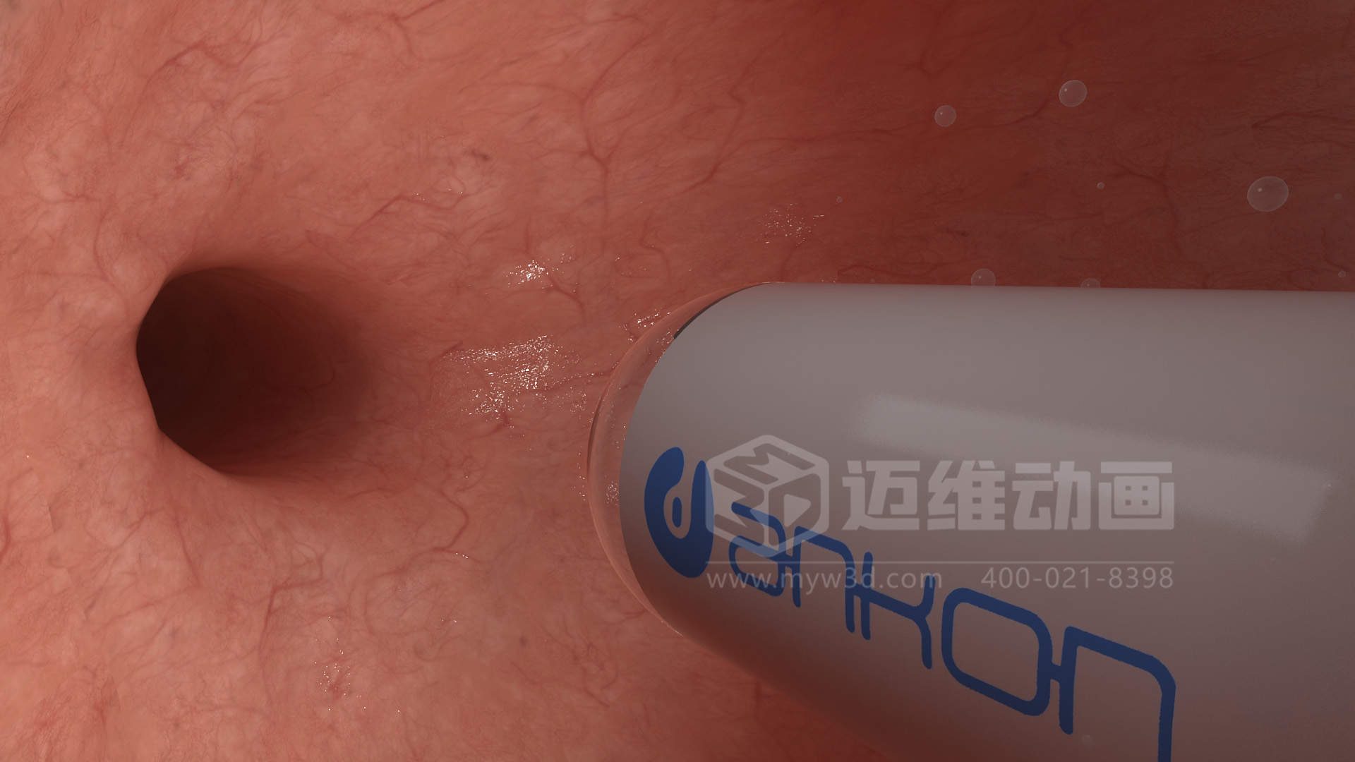 醫(yī)學檢測設備如何突破消化道檢查壁壘？三維動畫還原核心技術與臨床價值(圖4)